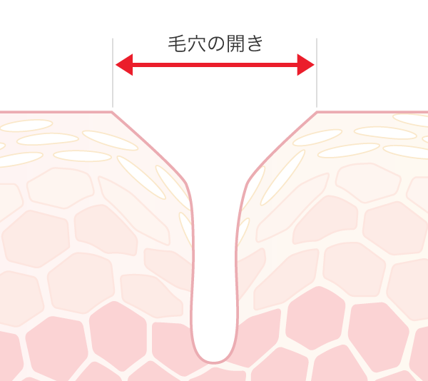 毛穴の開き