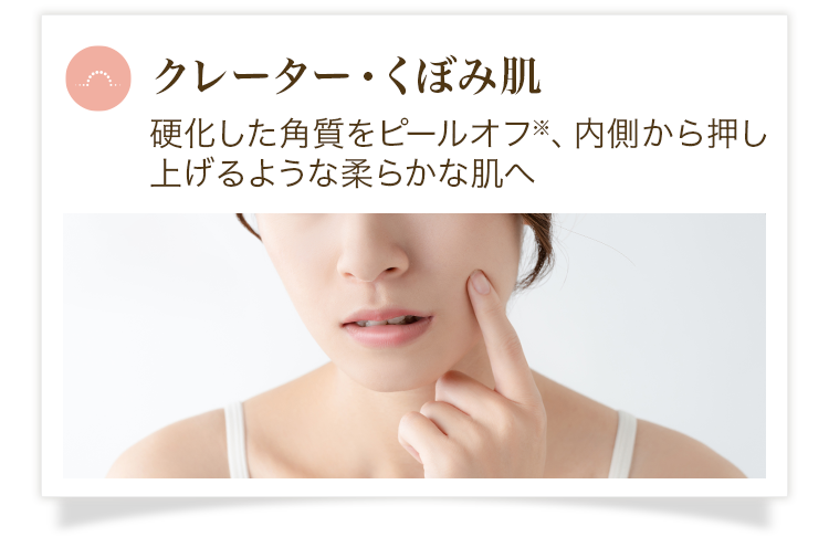 クレーター・くぼみ肌 硬化した角質をピールオフ※、内側から押し上げるような柔らかな肌へ