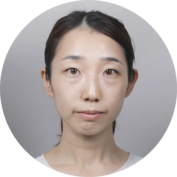 磯部様　スリーピングマスク使用前